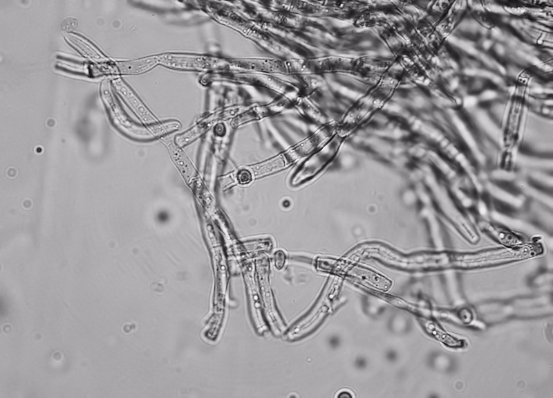 Myxo forma pseudoaethelium caffelatte
