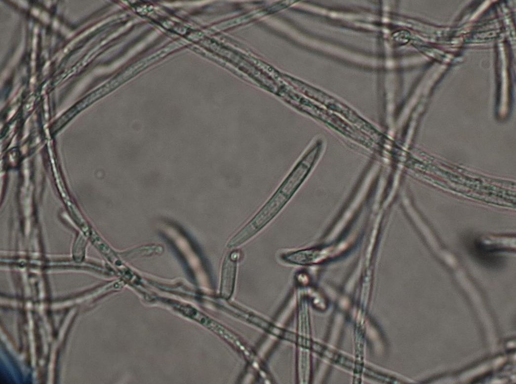 Un Fusarium con 0-3 septa