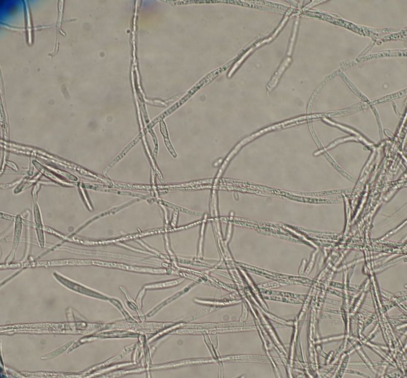 Un Fusarium con 0-3 septa