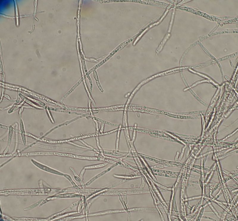 Un Fusarium con 0-3 septa