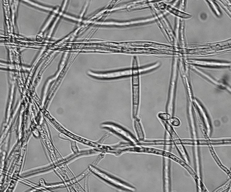 Un Fusarium con 0-3 septa