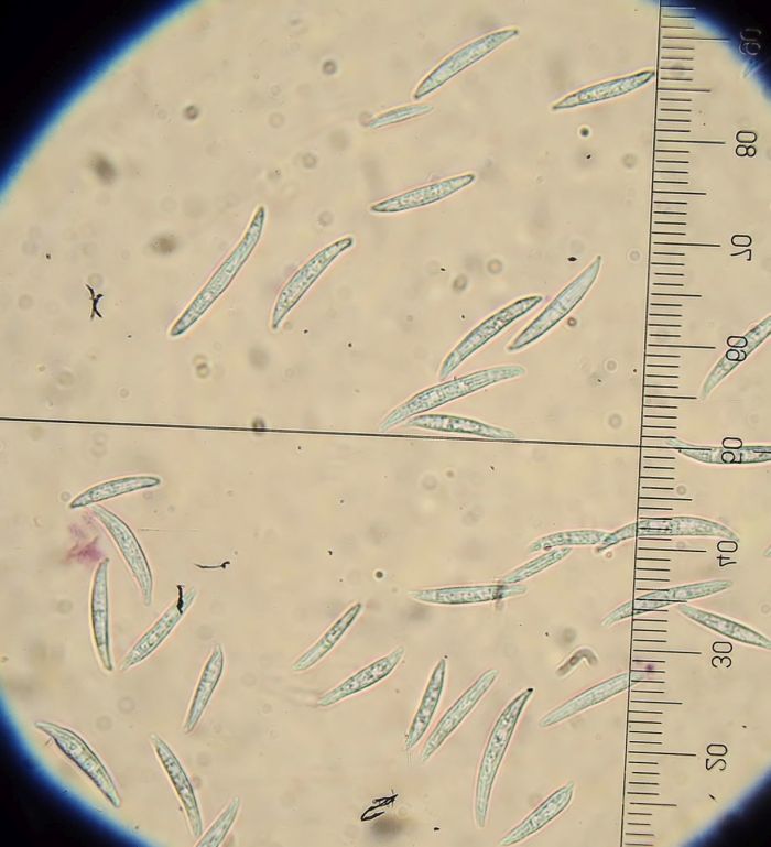 Un Fusarium con 0-3 septa