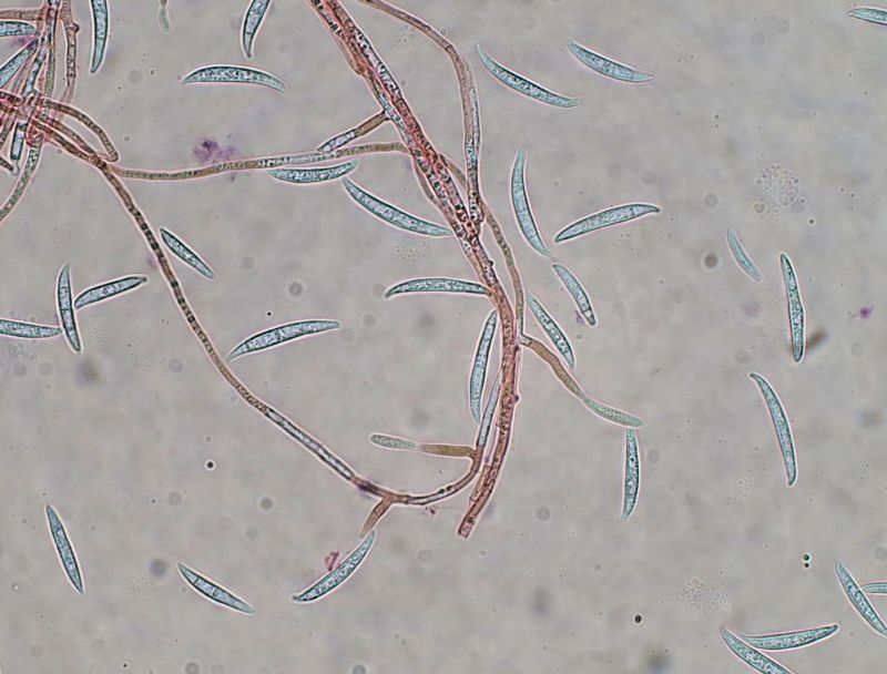 Un Fusarium con 0-3 septa