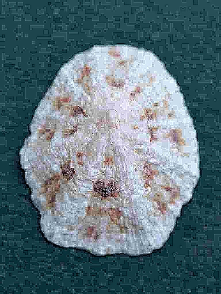 Patella sp.