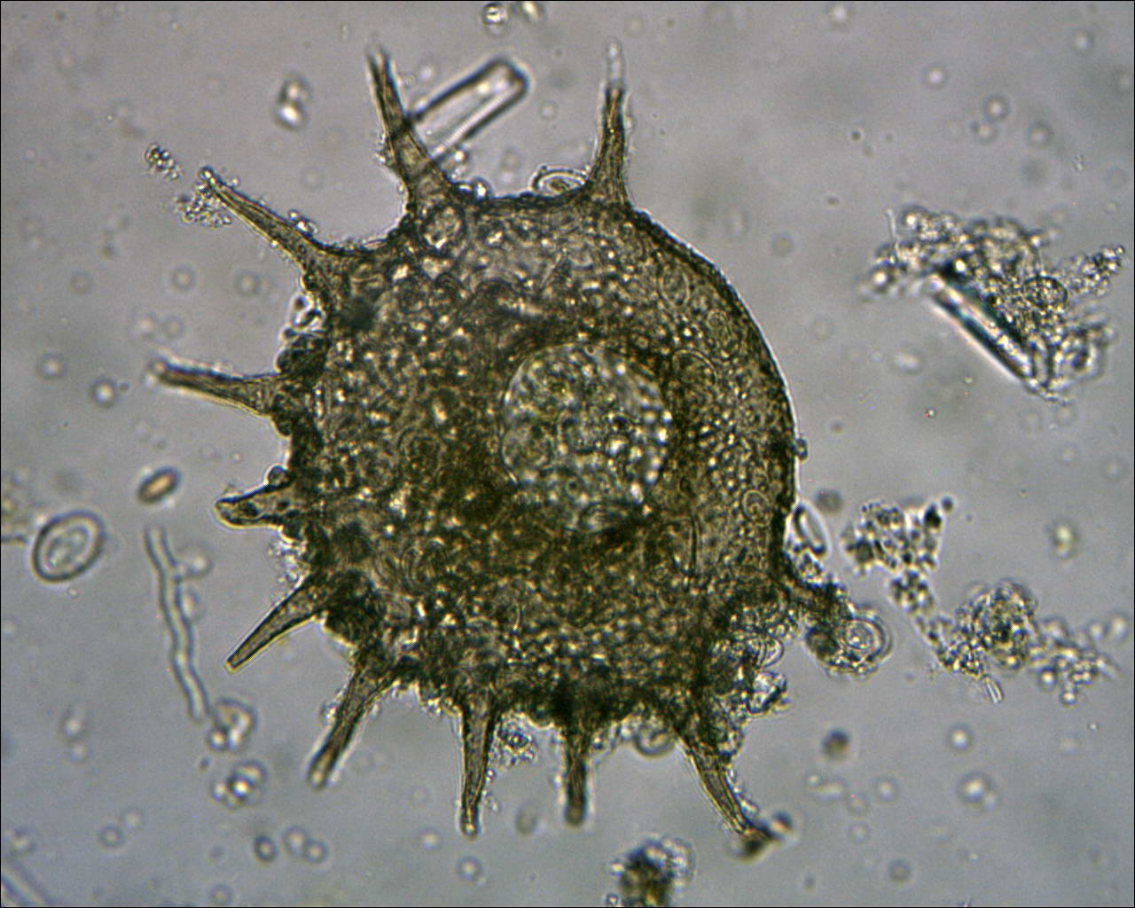 Centropyxis sp.