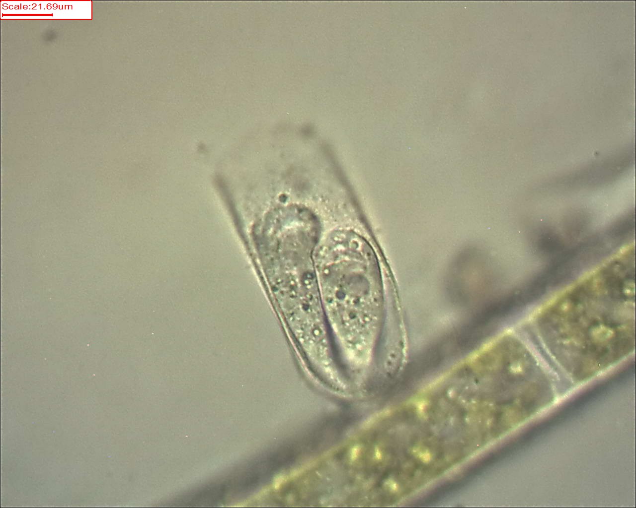 Vaginicola subcrystallina (rielaborazione)