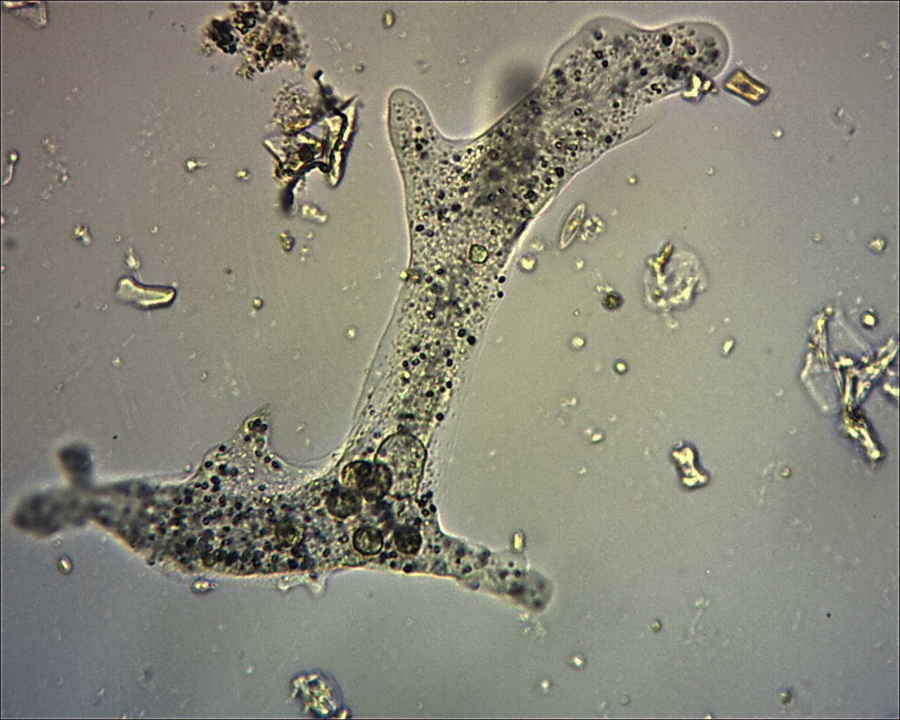 ameba (rielaborazione)