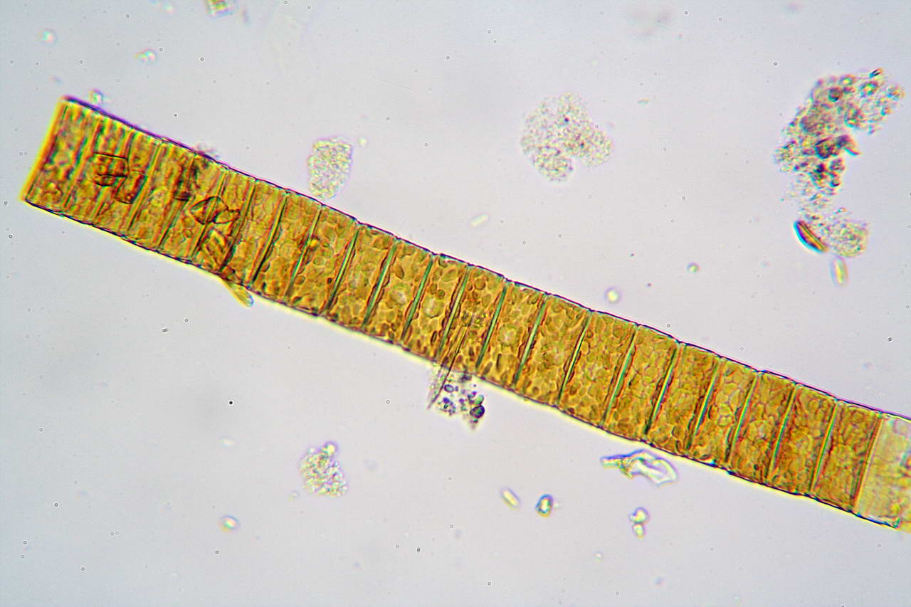 Fragilaria (foto Canon)