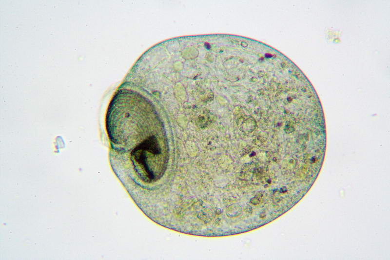Stentor Coeruleus