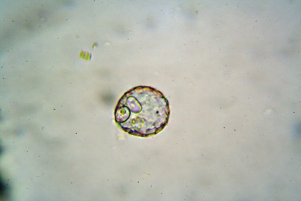 Ancora Difflugia (forse vuota)