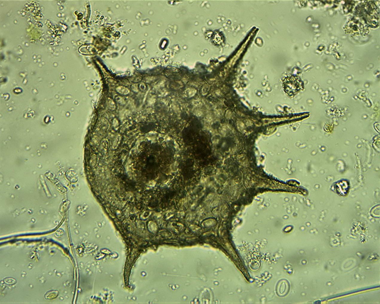 Centropyxis sp.