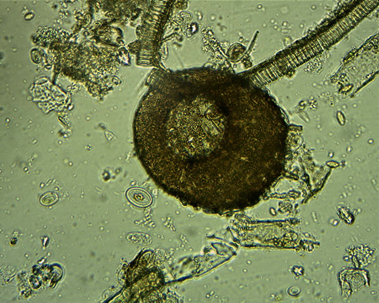 Centropyxis sp.