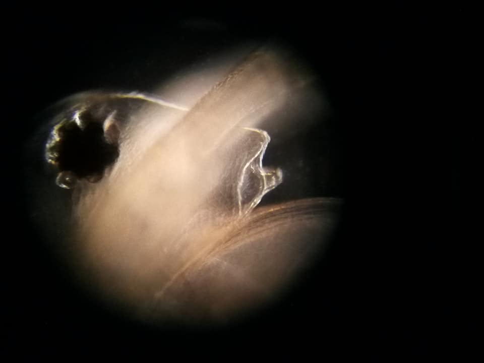 Polimorfismo Daphnia sp (D magna?)