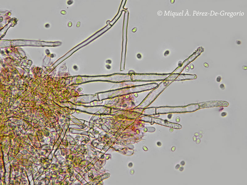 Hyphodontia alienata? (Amphinema byssoides)