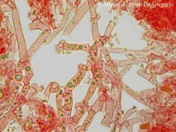 Sistotrema a confermare (Sistotrema cf. octosporum)