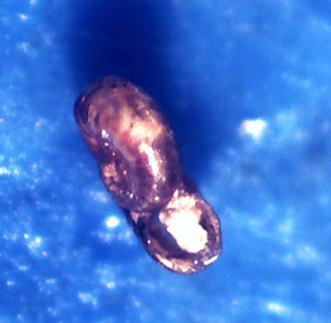 Retrotortina fuscata??