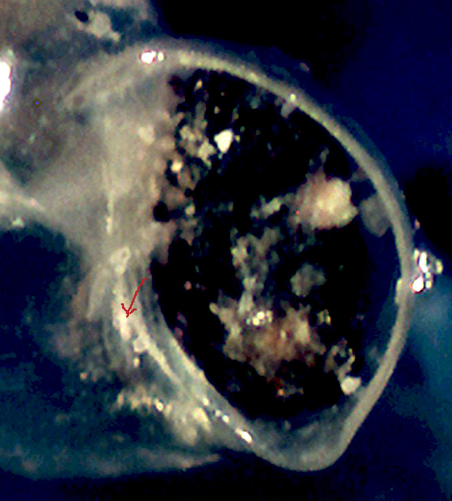 Setia da identificare