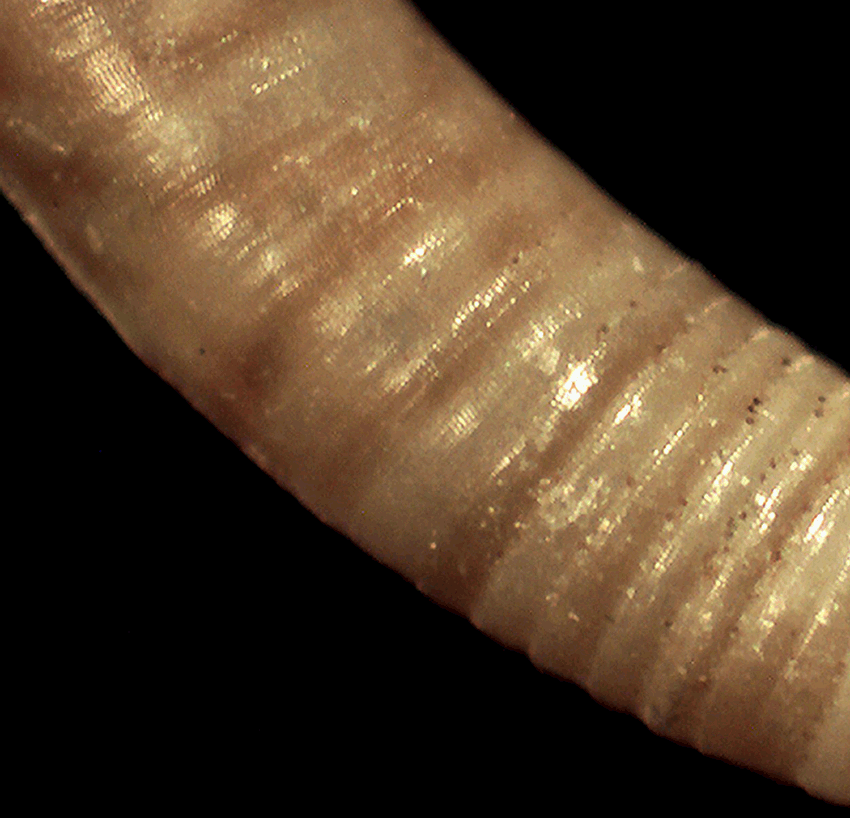 Caecum da identificare