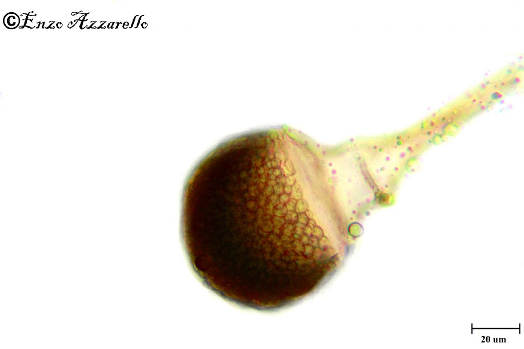 Muffa del riso e del pane - Rhizopus