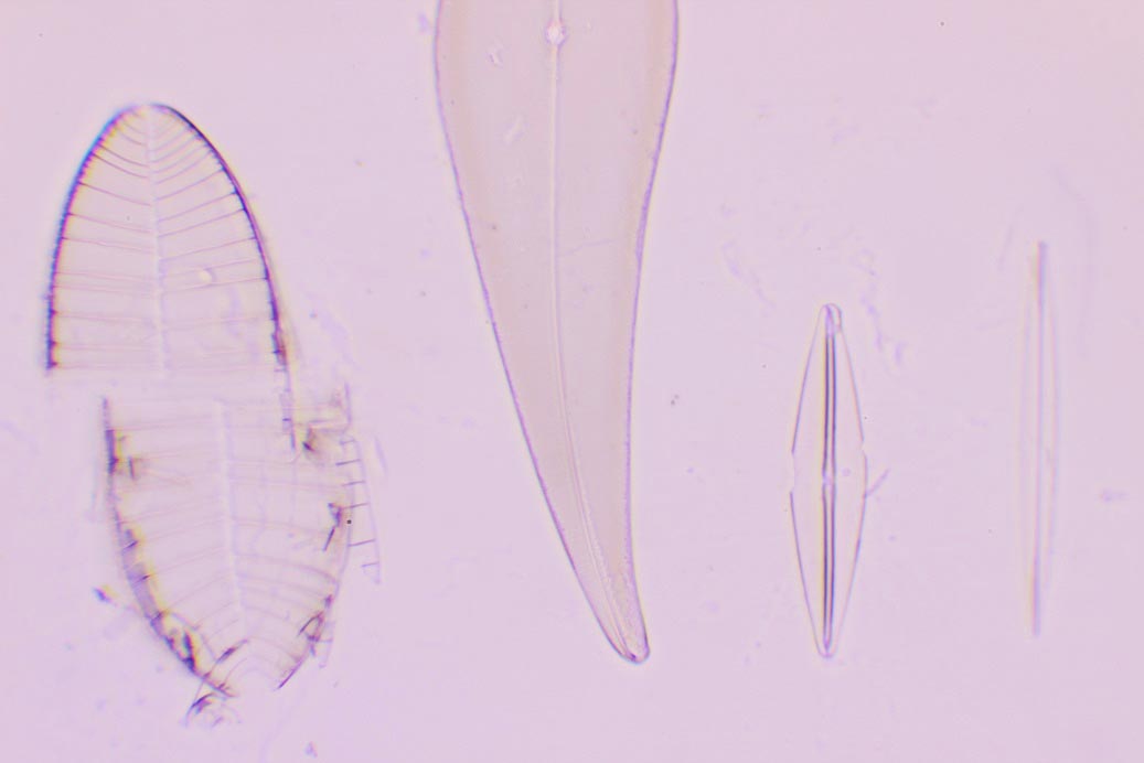 TEST PLATE 8 FORMS Si  rotta la quinta diatomea