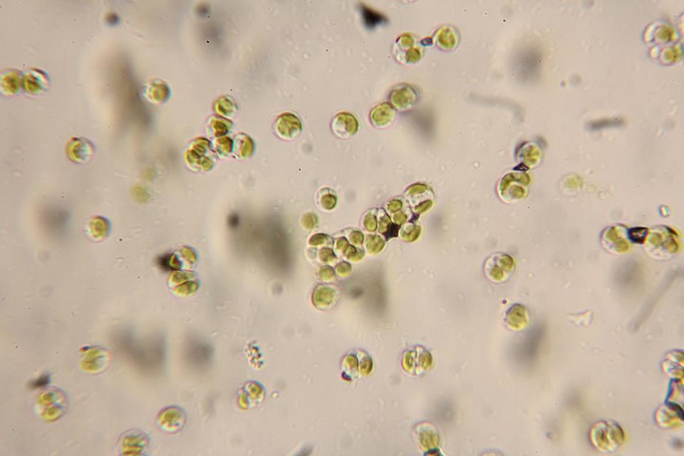 Nannochloris?