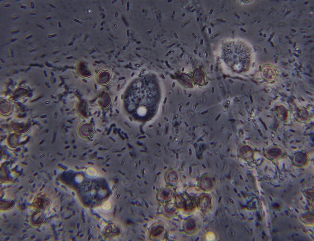 prove di coltivazione di Stemonitis