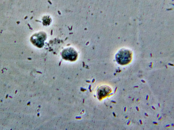 prove di coltivazione di Stemonitis