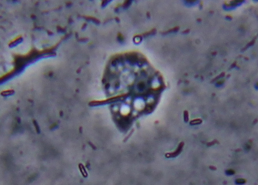 prove di coltivazione di Stemonitis