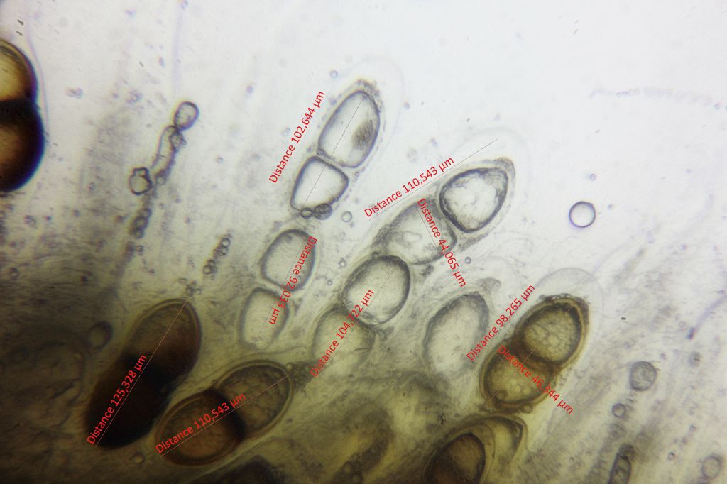 Solorina bispora subsp. macrospora