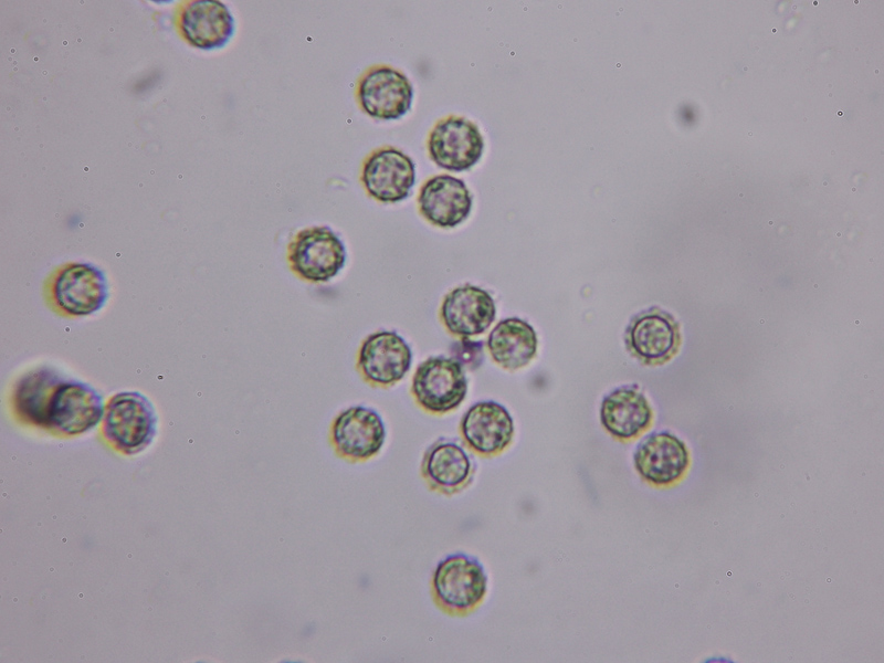 Identificazione Lycogala sp.
