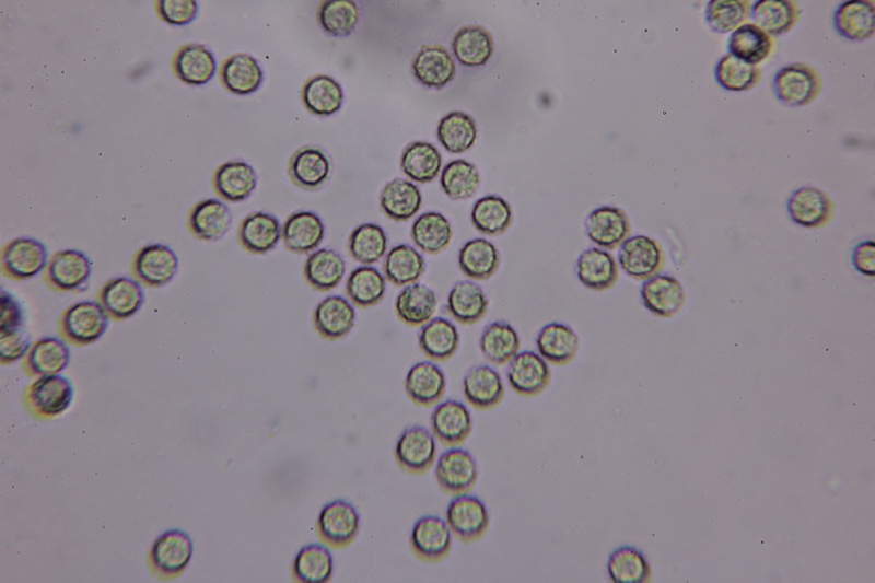 Identificazione Lycogala sp.