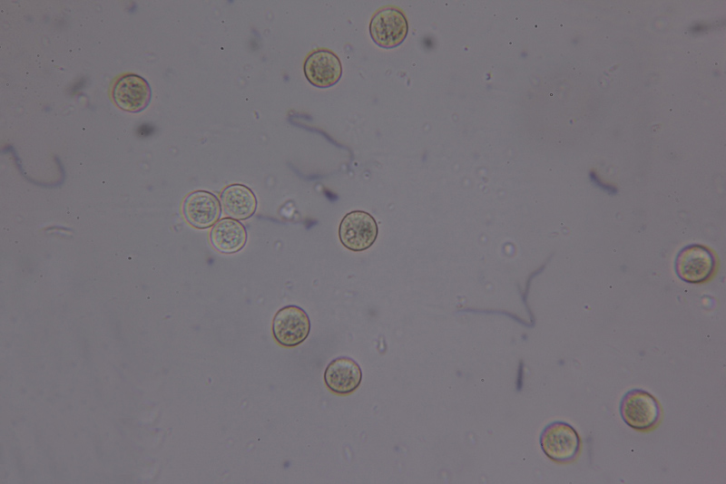 Trichia decipiens (Pers.) T. Macbr.