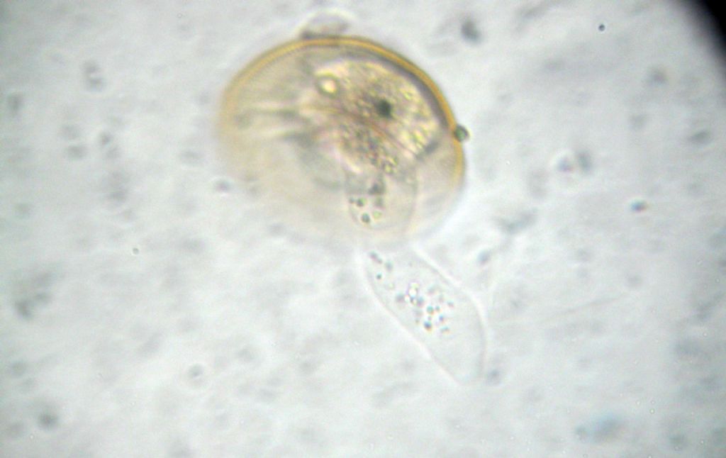 Nascita di una Arcella