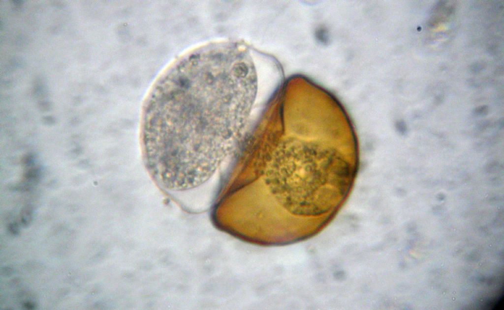 Nascita di una Arcella