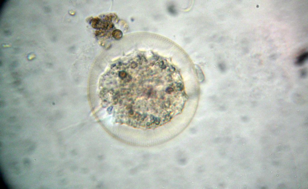 Nascita di una Arcella