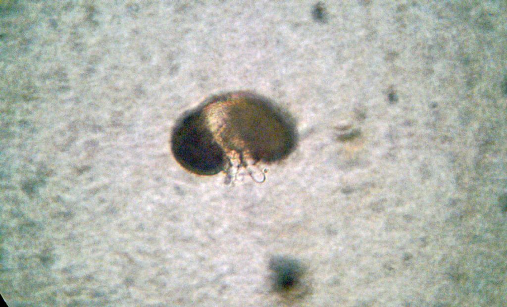 Fungo microscopico?