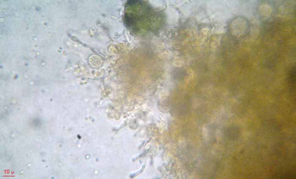 Troppo rossa per essere Tremella mesenterica?