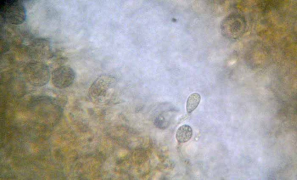 Troppo rossa per essere Tremella mesenterica?