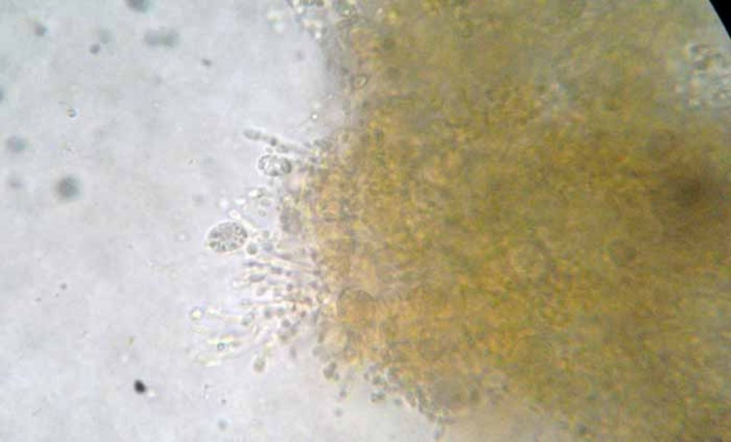 Troppo rossa per essere Tremella mesenterica?