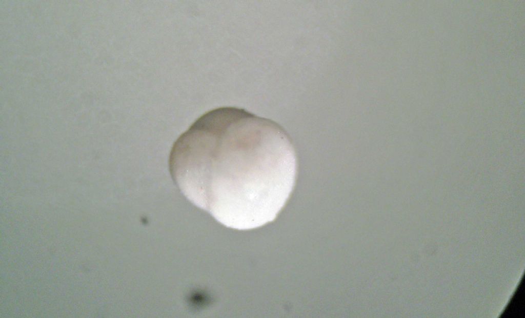 Foraminiferi fossili: Sphaeroidina bulloides?