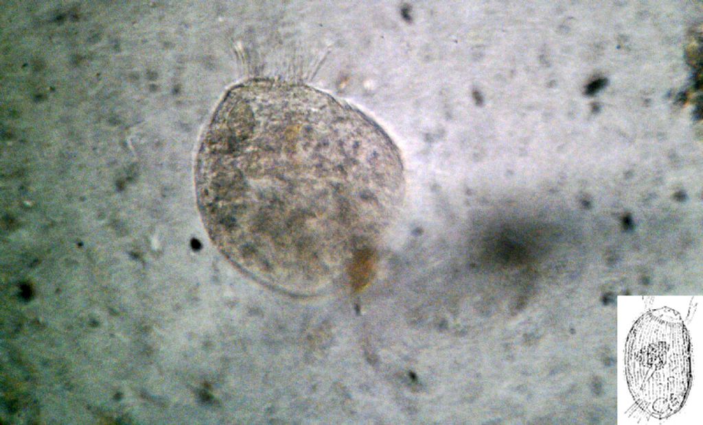 Due protozoi a sfera