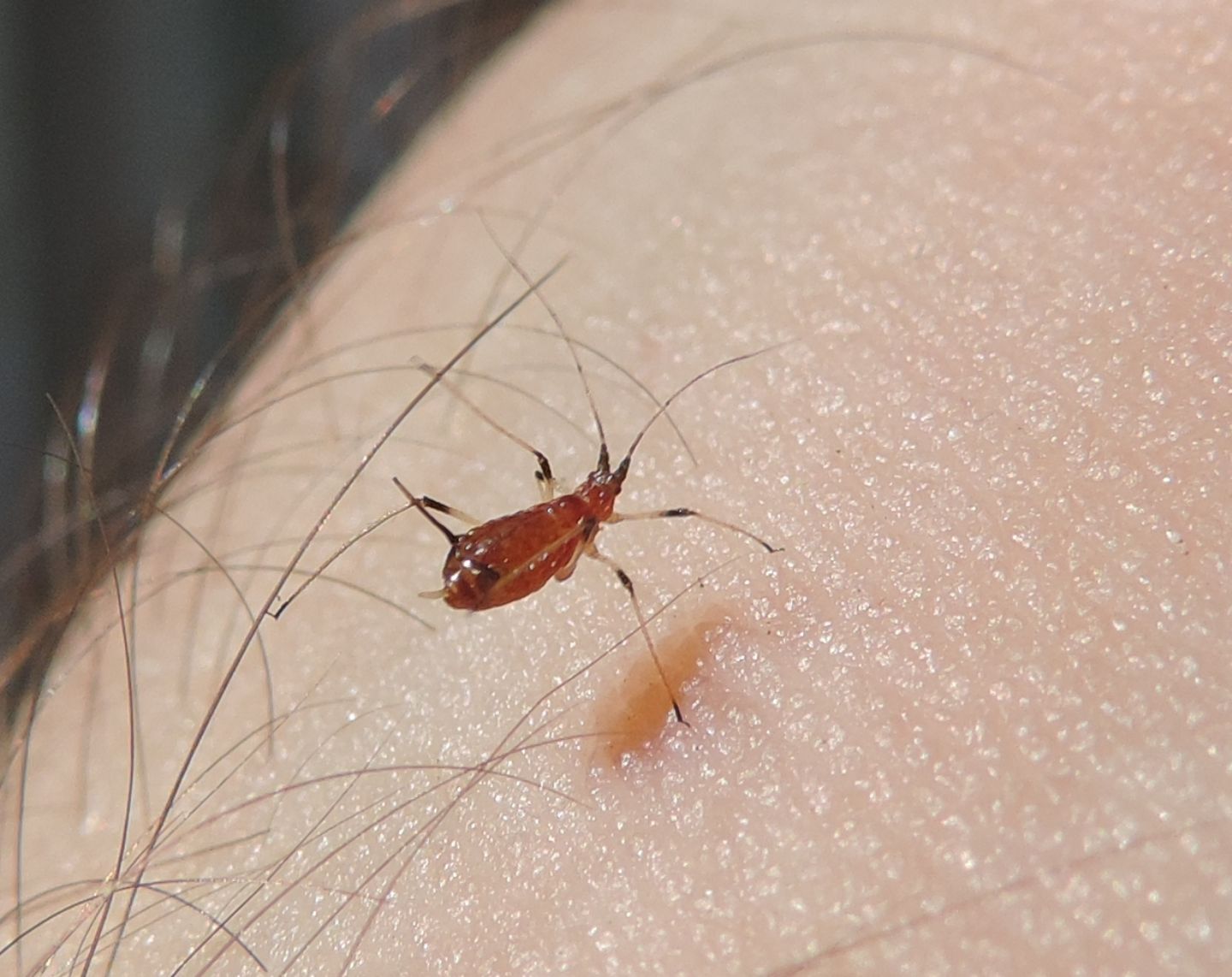 Macrosiphum rosae (Aphididae)