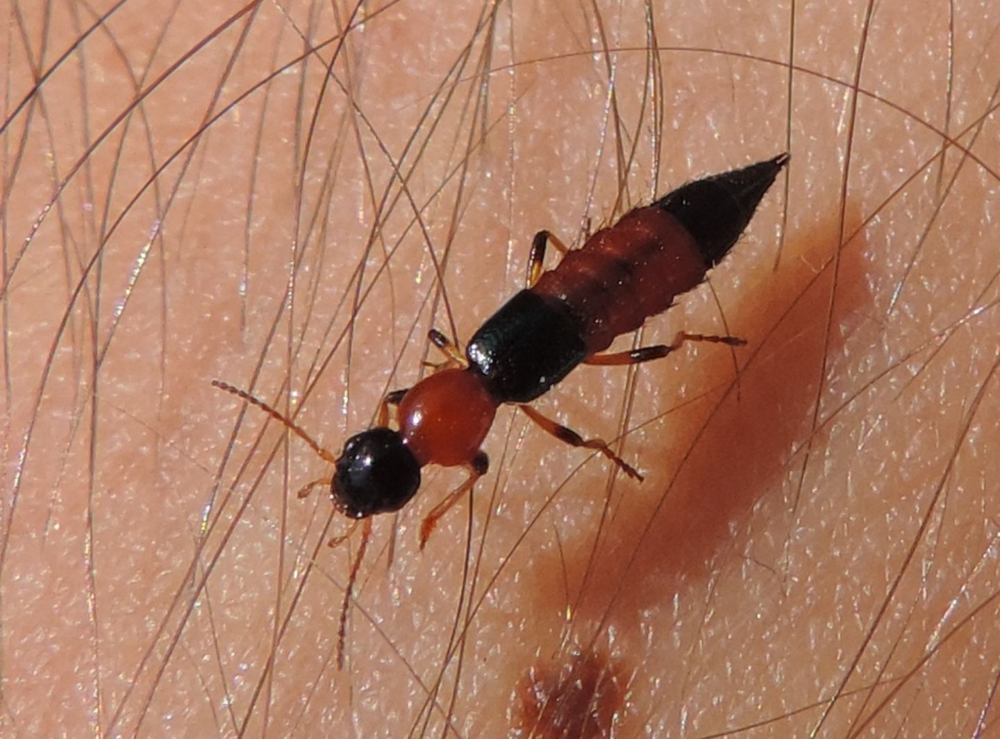 Staphylinidae: Paederus cfr. littoralis