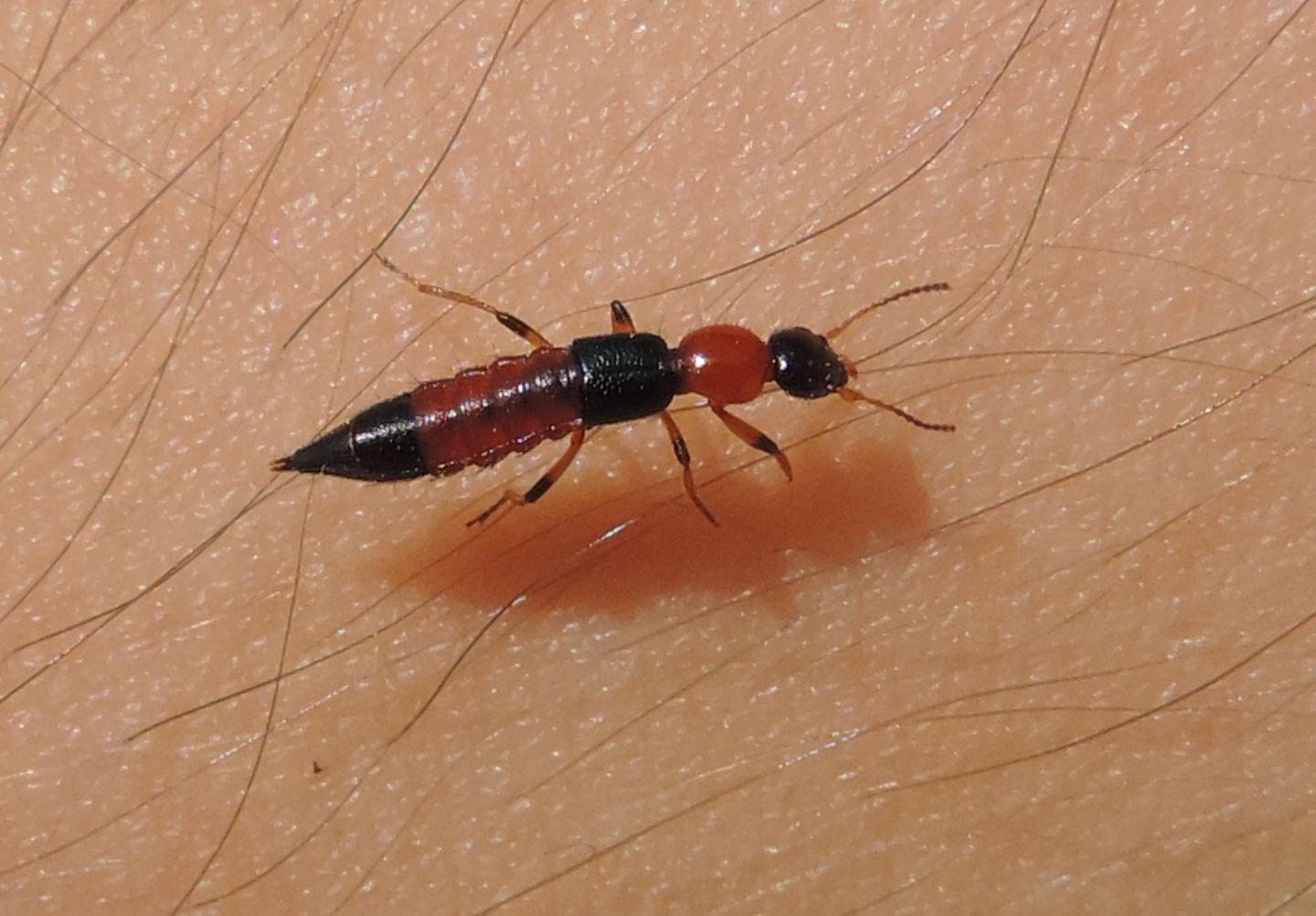 Staphylinidae: Paederus cfr. littoralis