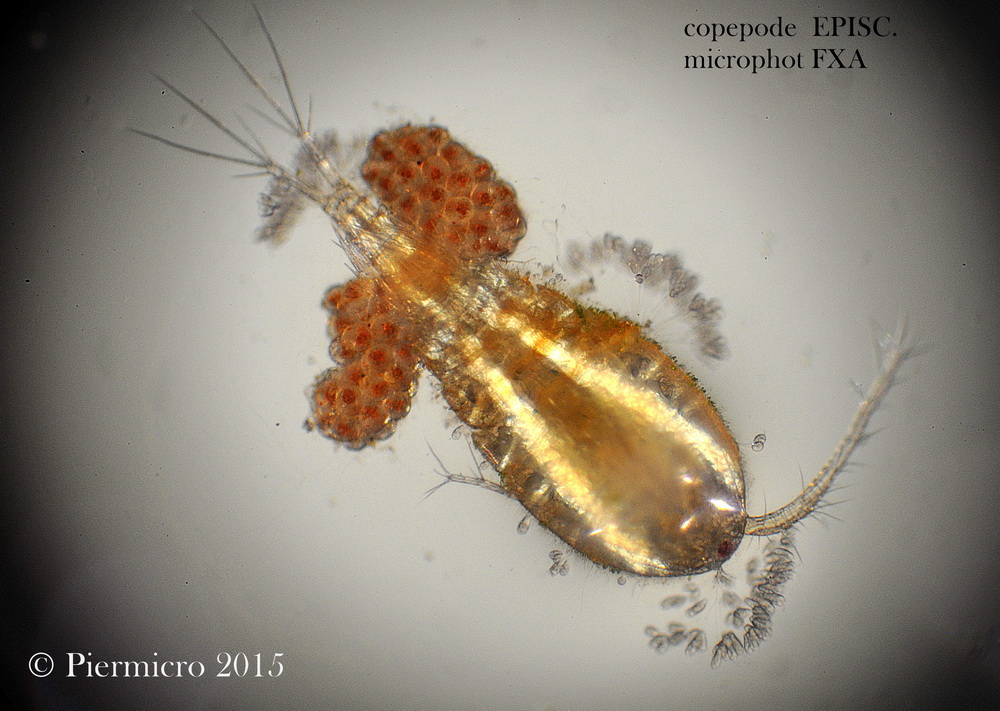 Copepode ricoperto da vorticelle.