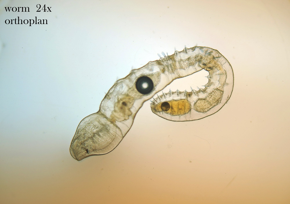 Verme fotogenico, credo sia un nematode.