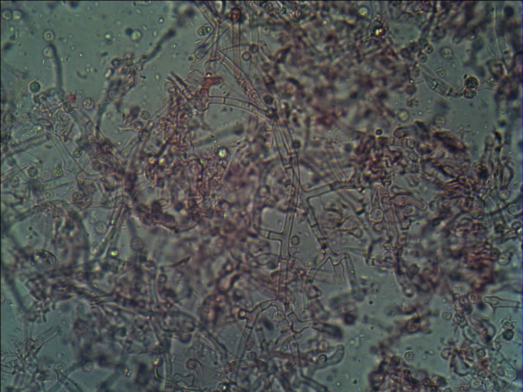 corticie spore epineuse (Pseudotomentella af. mucidula)
