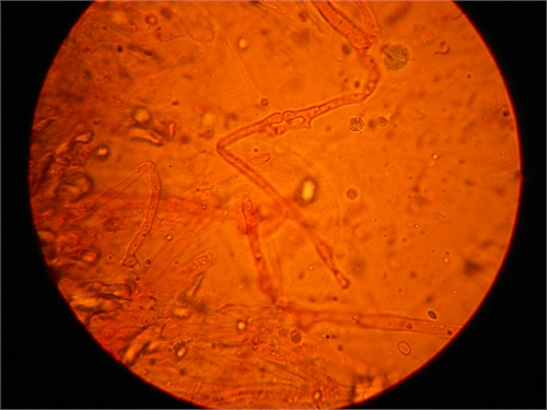 Fungo del Pollino da determinare