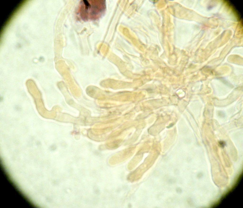 Crosta soffice bianca (Fibulomyces mutabilis)