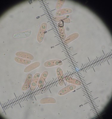 Hyphoderma? (Hyphoderma transiens)